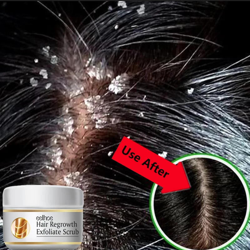 Fast Anti Dandruff Hair Treatm - Scalp Scrub Exfoliant のレビューと価格