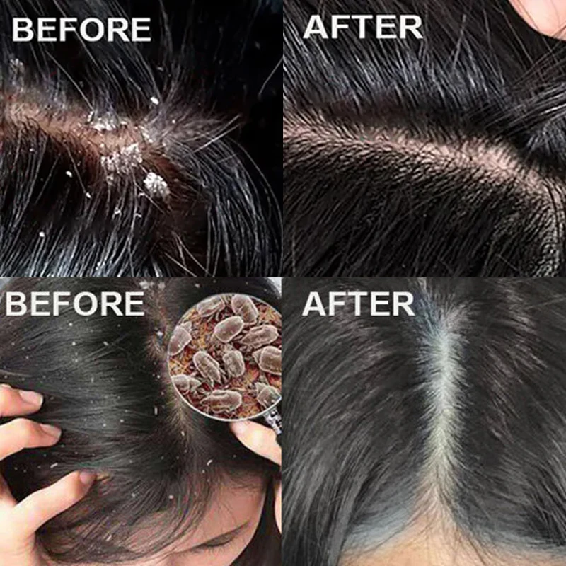 Fast Anti Dandruff Hair Treatm - Scalp Scrub Exfoliant のレビューと価格