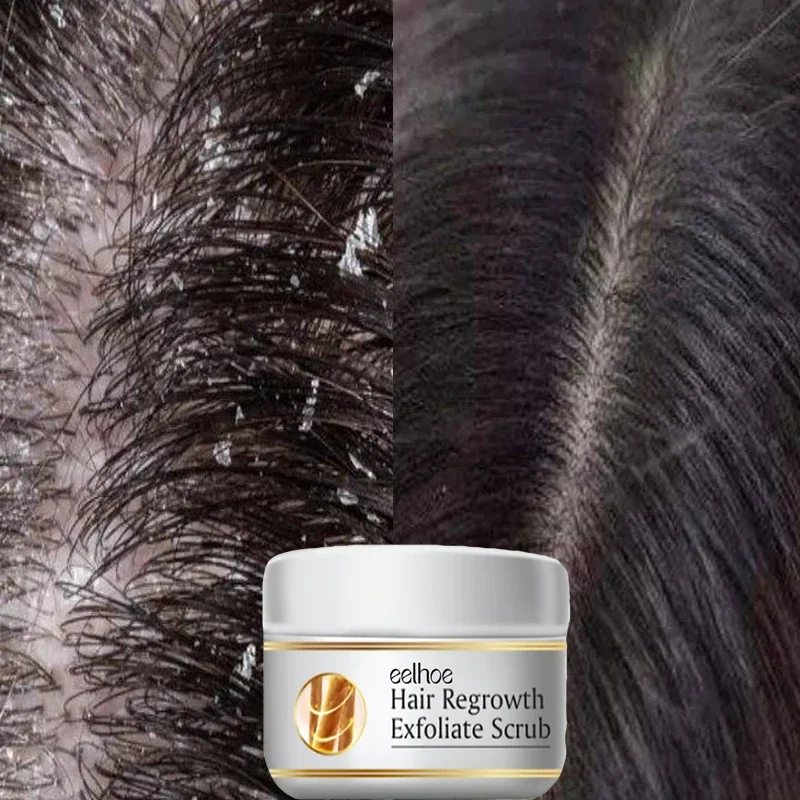 Fast Anti Dandruff Hair Treatm - Scalp Scrub Exfoliant のレビューと価格